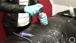 Sounding Dilator all the way in with Blue Rubber Gloves