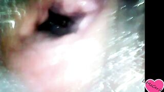 LittleCerika View Inside My pussy, endoscope